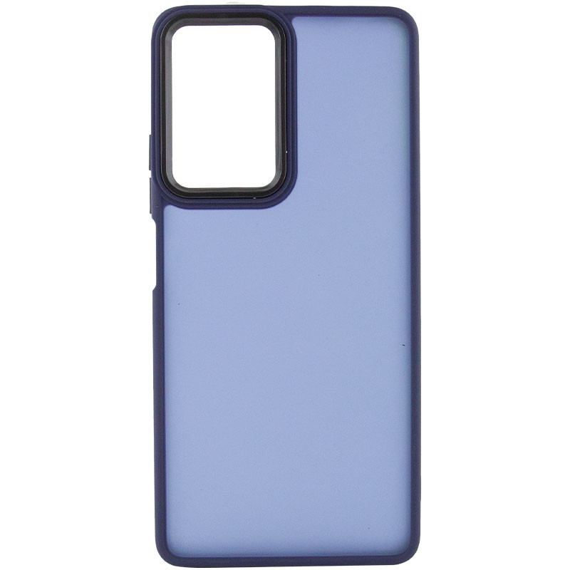 Чохол TPU + PC Lyon Frosted для Xiaomi Redmi Note 10 Pro / 10 Pro Max