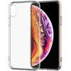 TPU чохол Epic Transparent 1,5mm для Apple iPhone X / XS (5.8") Безбарвний (прозорий)